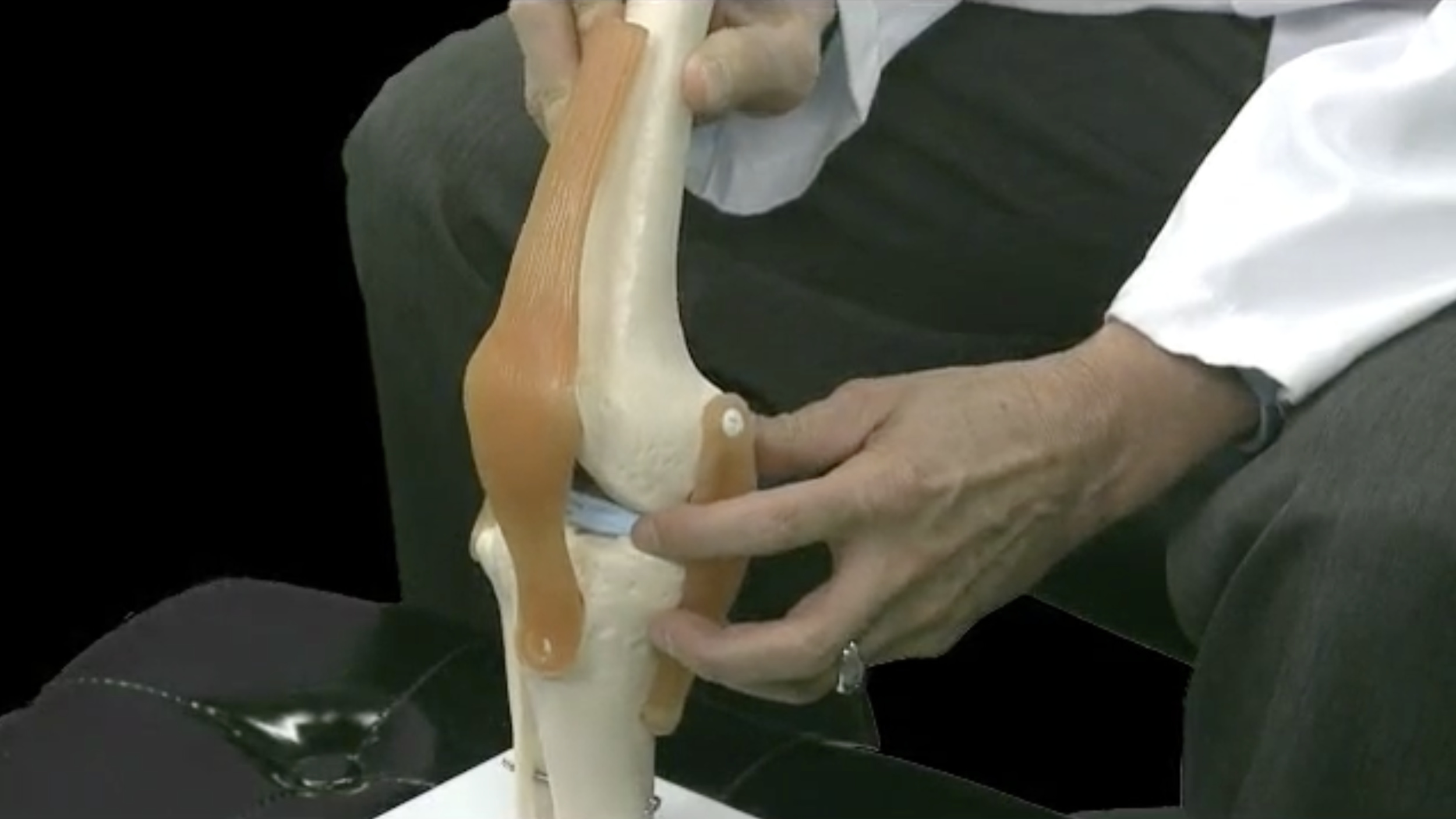 Doctor displaying anatomical model of the knee joint.