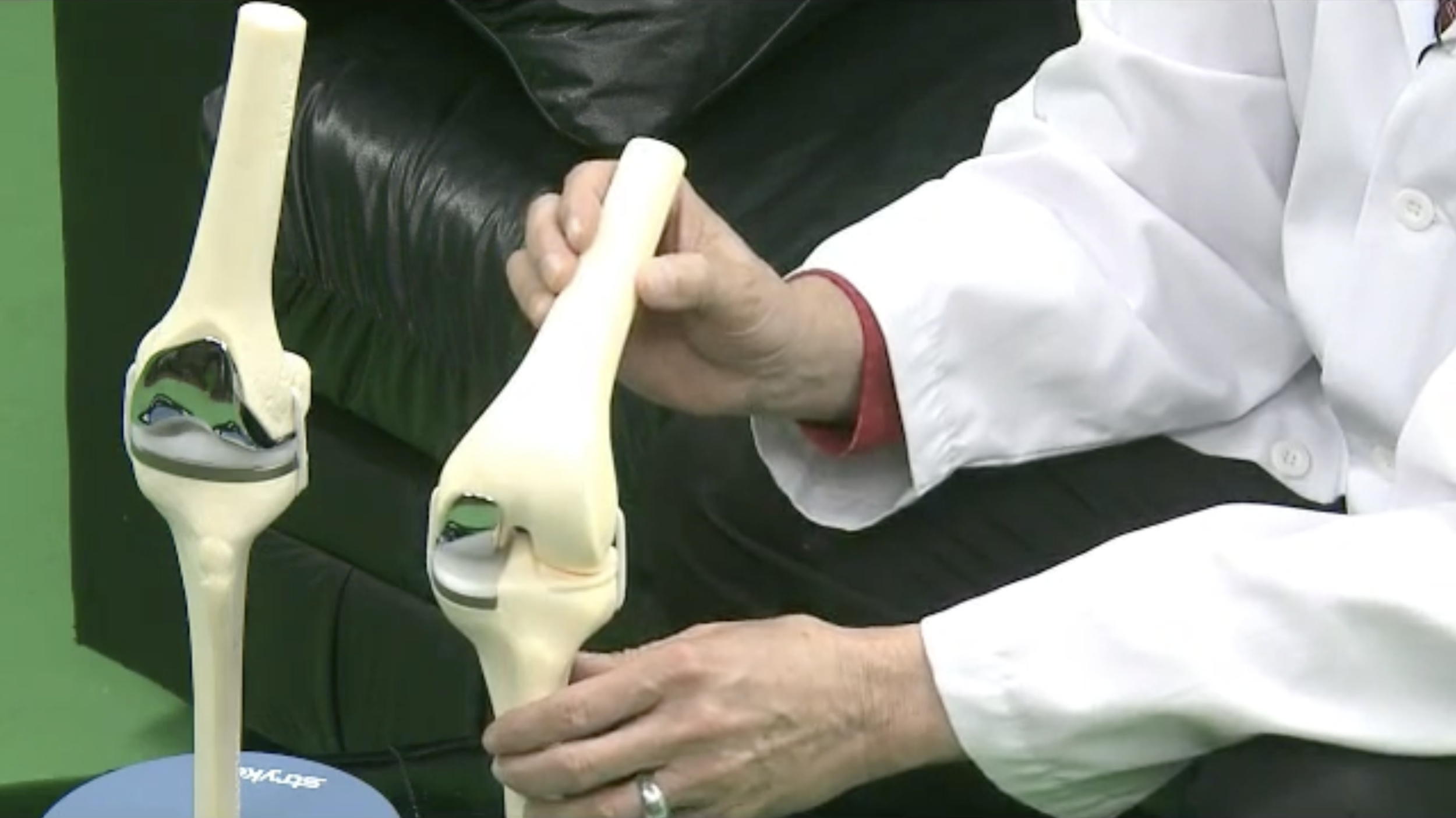 Doctor comparing two models of knee anatomy.